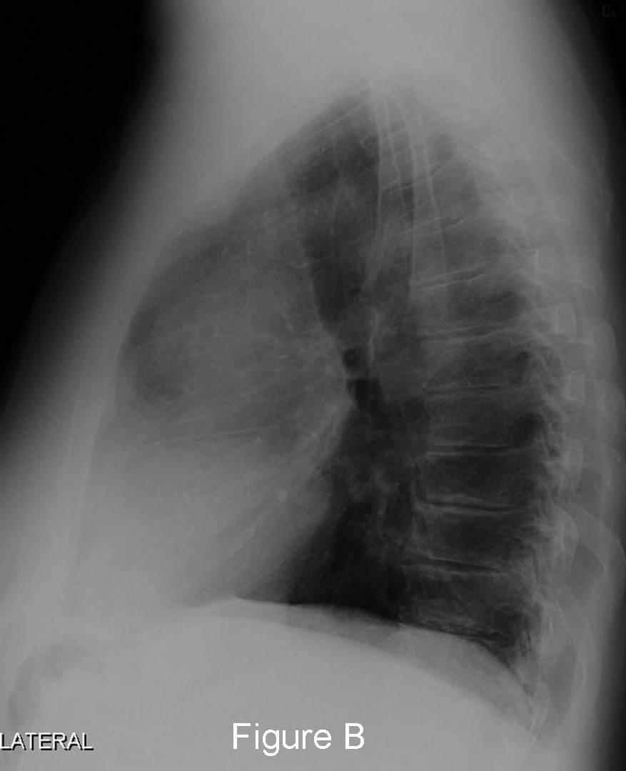 Radiograph 4 from archived case 46