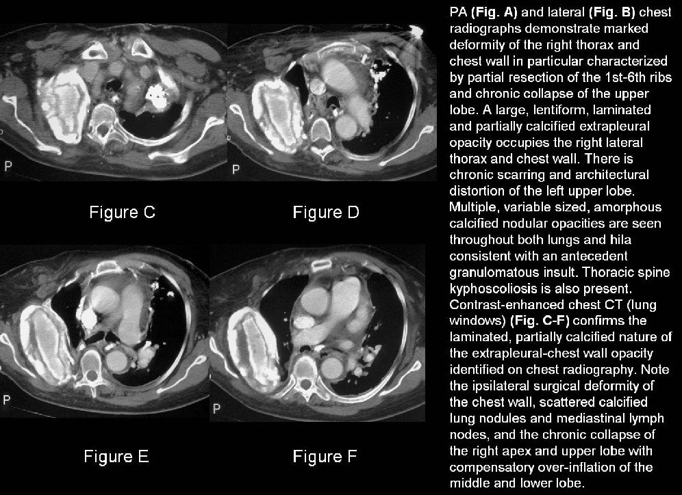 Radiograph 4 from archived case 29