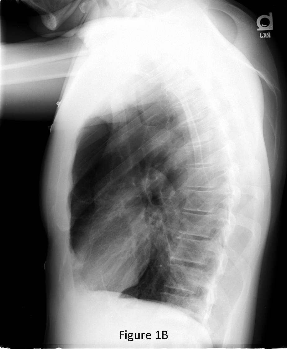 Radiograph 4 from archived case 70