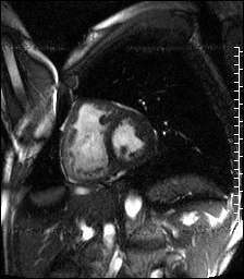 Radiograph 2 from archived case 69