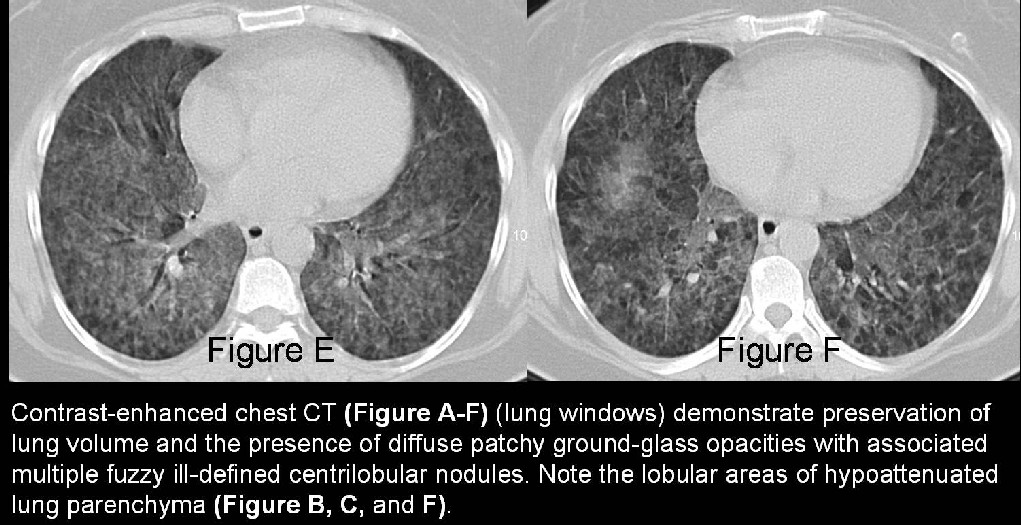 Radiograph 4 from archived case 22