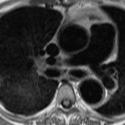 Radiograph 2 from archived case 51