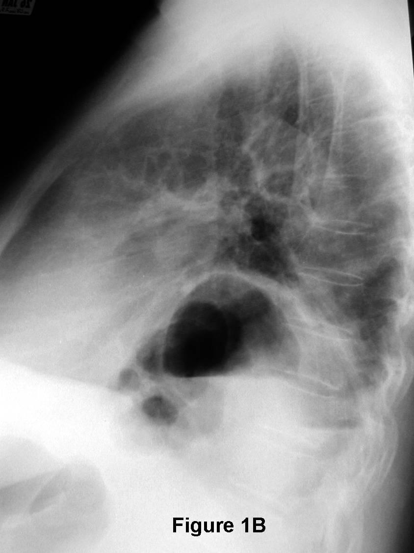 Radiograph 4 from archived case 76