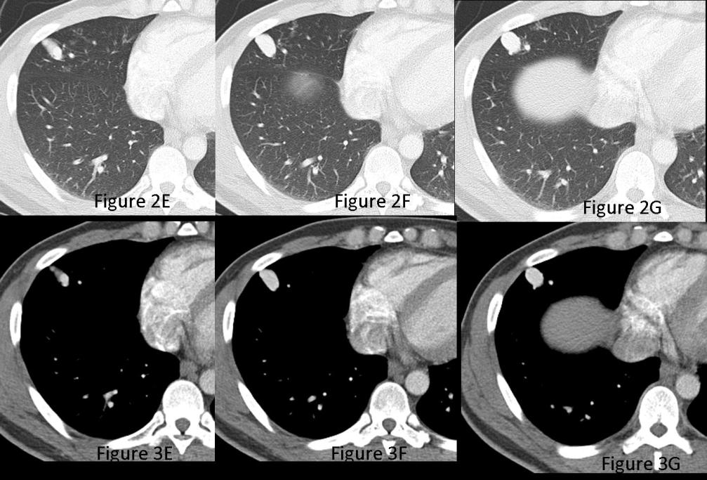 Radiograph 3 from archived case 71