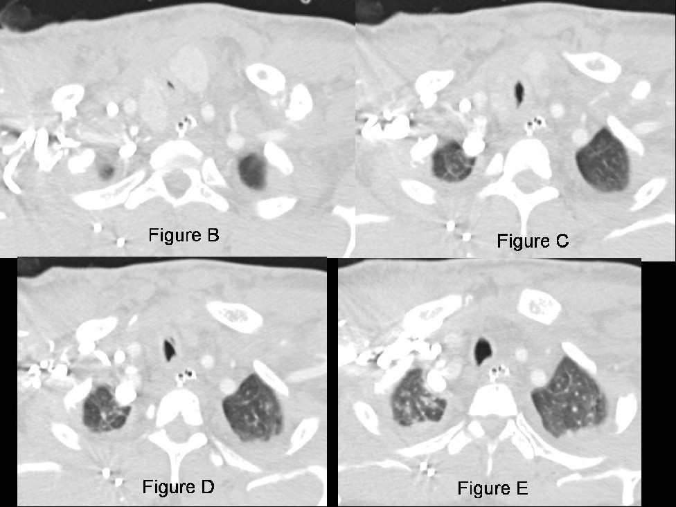 Radiograph 3 from archived case 31
