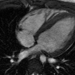 Radiograph 2 from archived case 50
