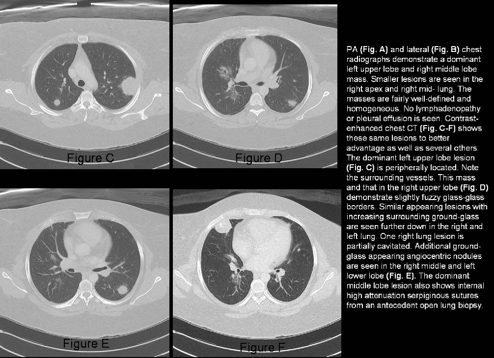 Radiograph 5 from archived case 33
