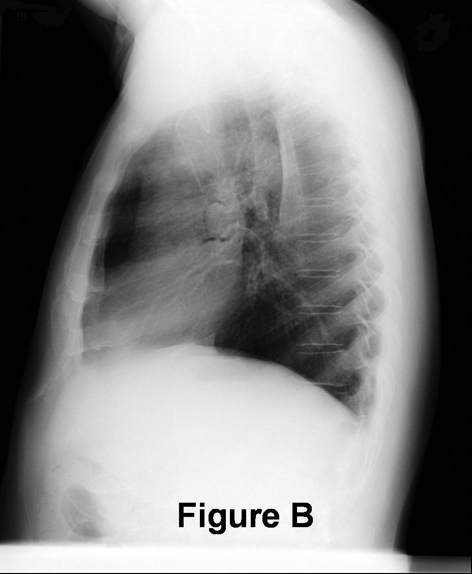 Radiograph 2 from archived case 37