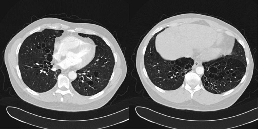 Radiograph 2 from archived case 7