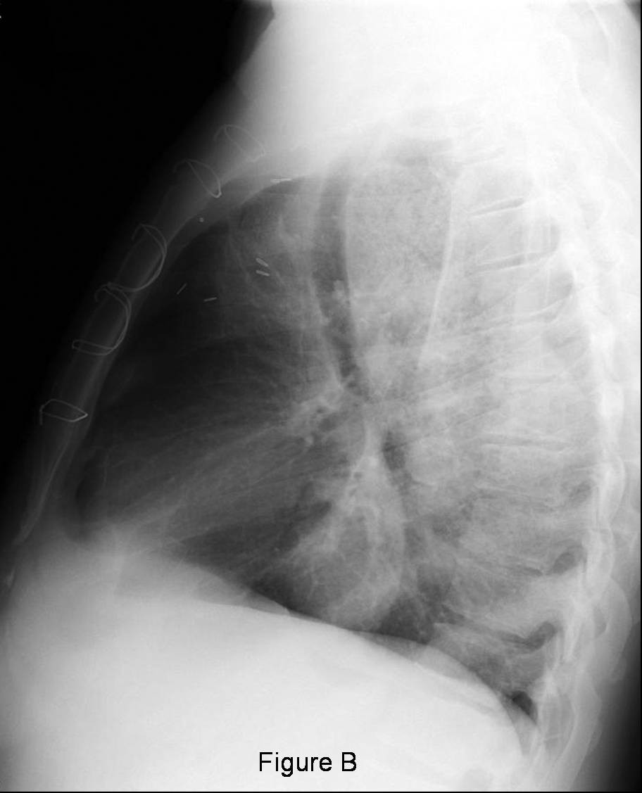 Radiograph 2 from archived case 45
