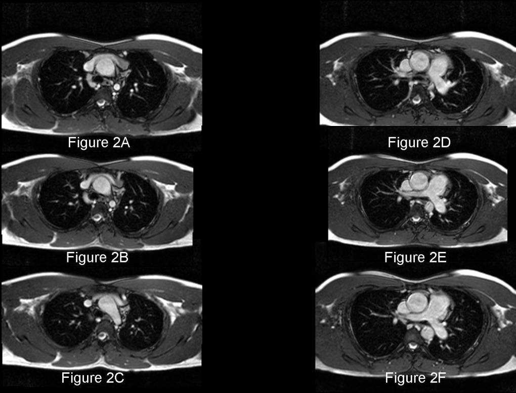 Radiograph 2 from archived case 57