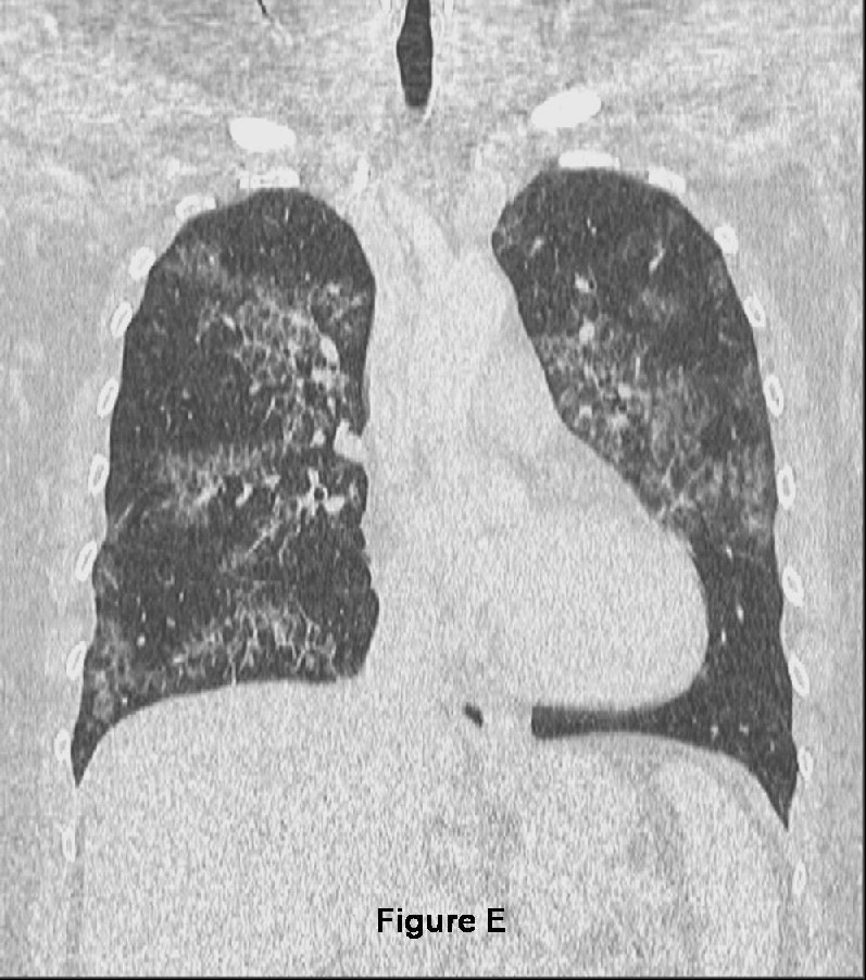 Radiograph 2 from archived case 12