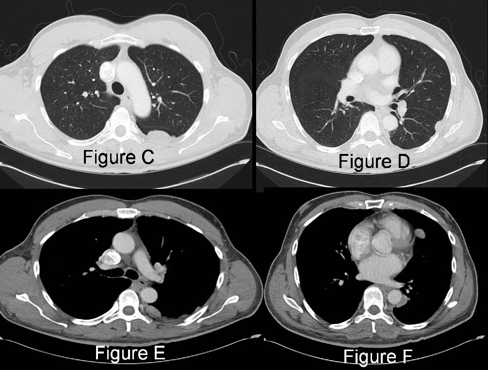 Radiograph 3 from archived case 15