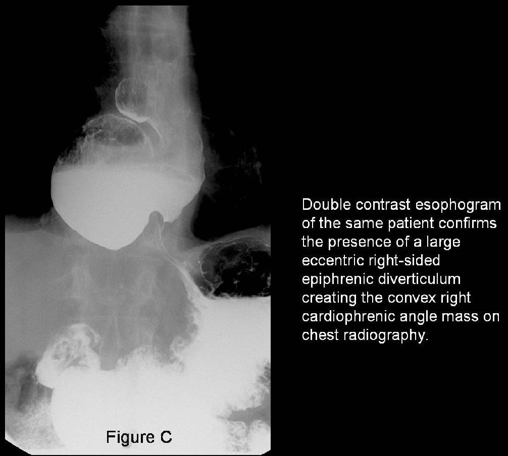 Radiograph 4 from archived case 26