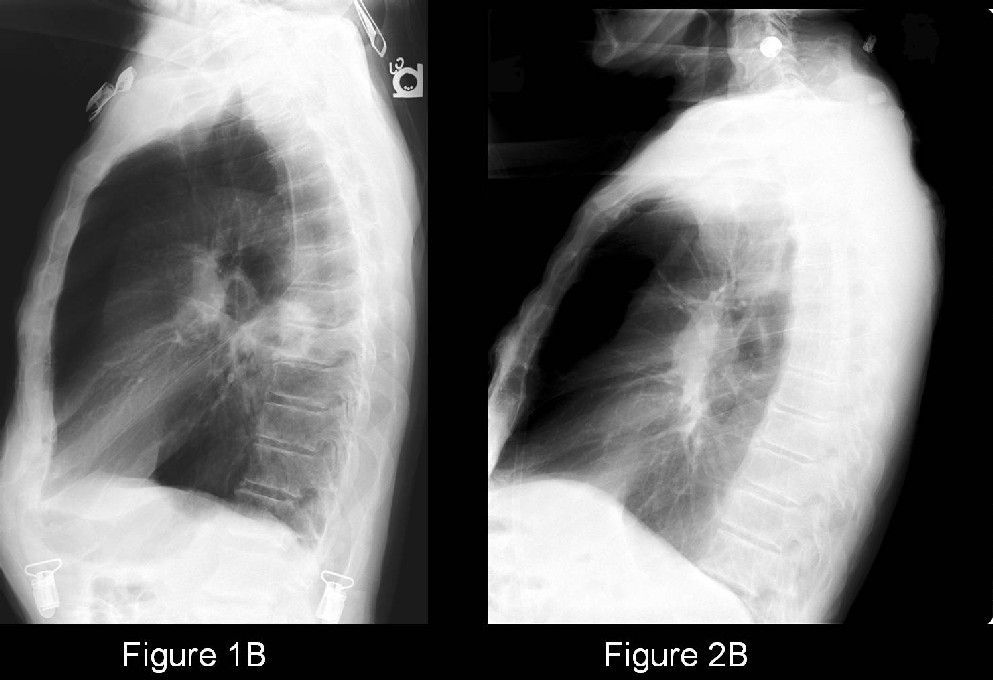 Radiograph 2 from archived case 35