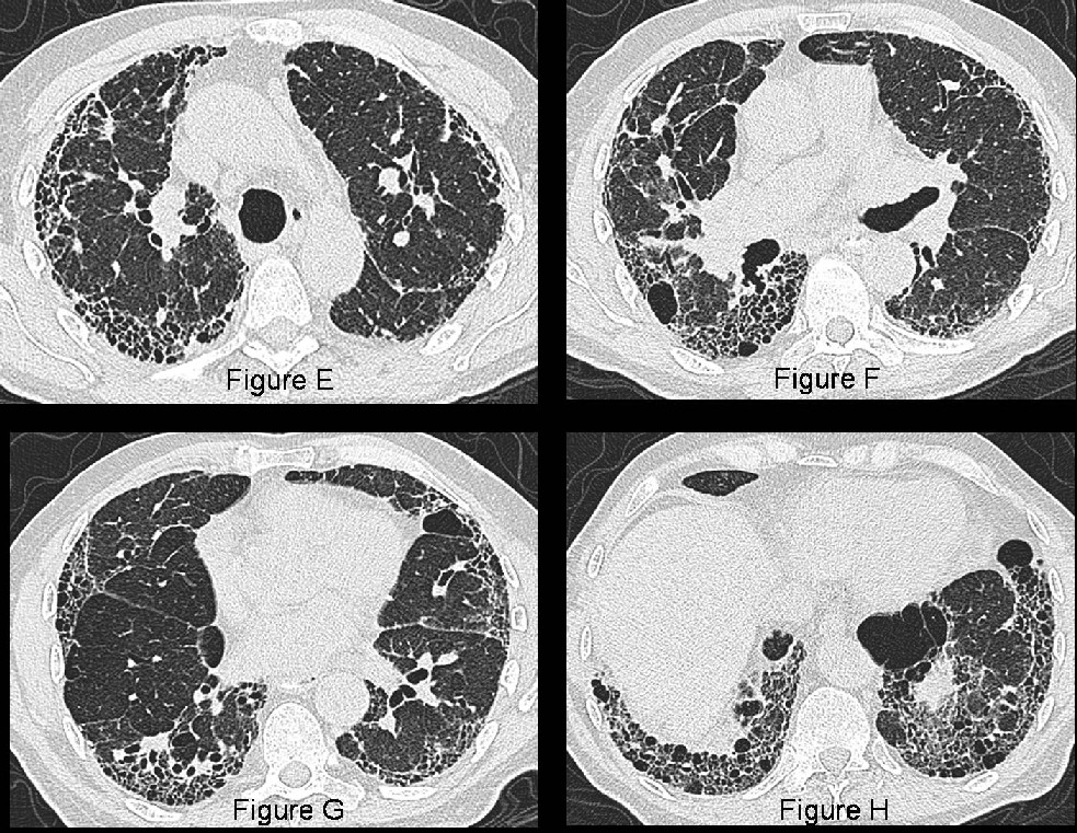 Radiograph 2 from archived case 27