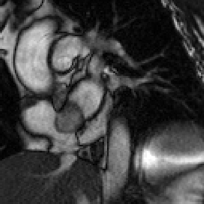 Radiograph 7 from archived case 20