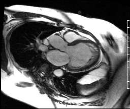 Radiograph 2 from archived case 42