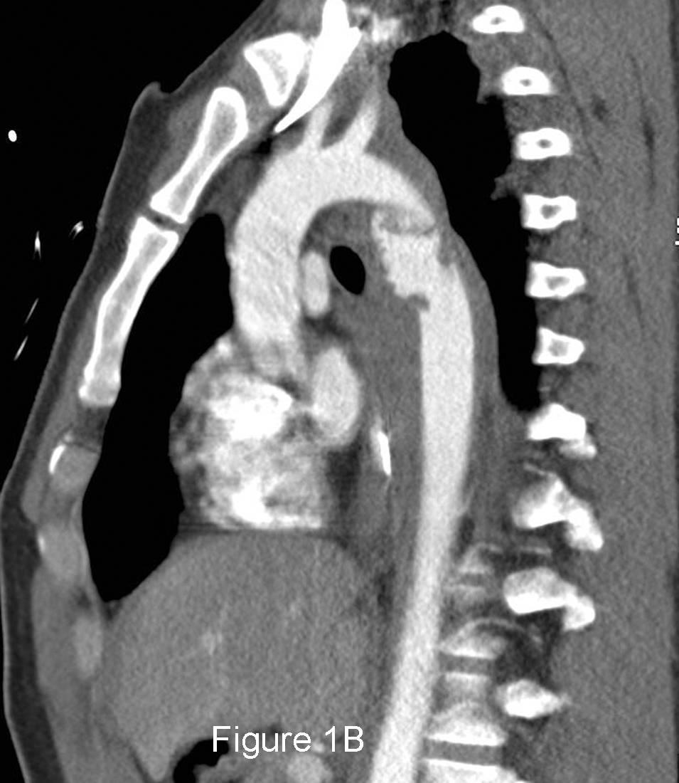 Radiograph 2 from archived case 68