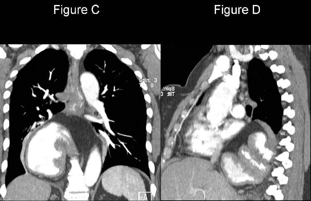 Radiograph 3 from archived case 19