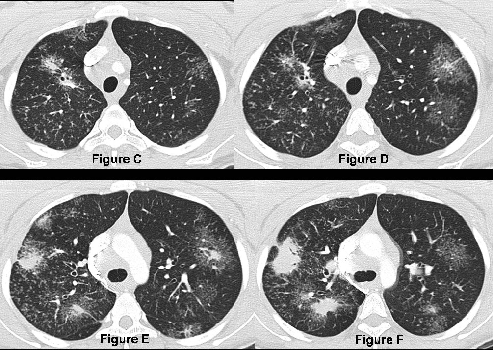 Radiograph 4 from archived case 23