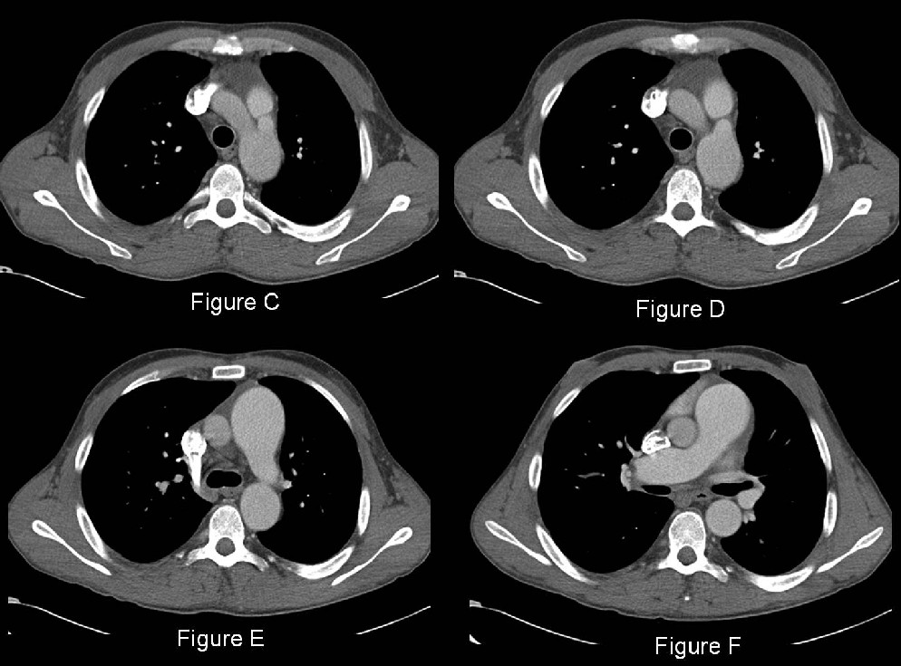 Radiograph 5 from archived case 40