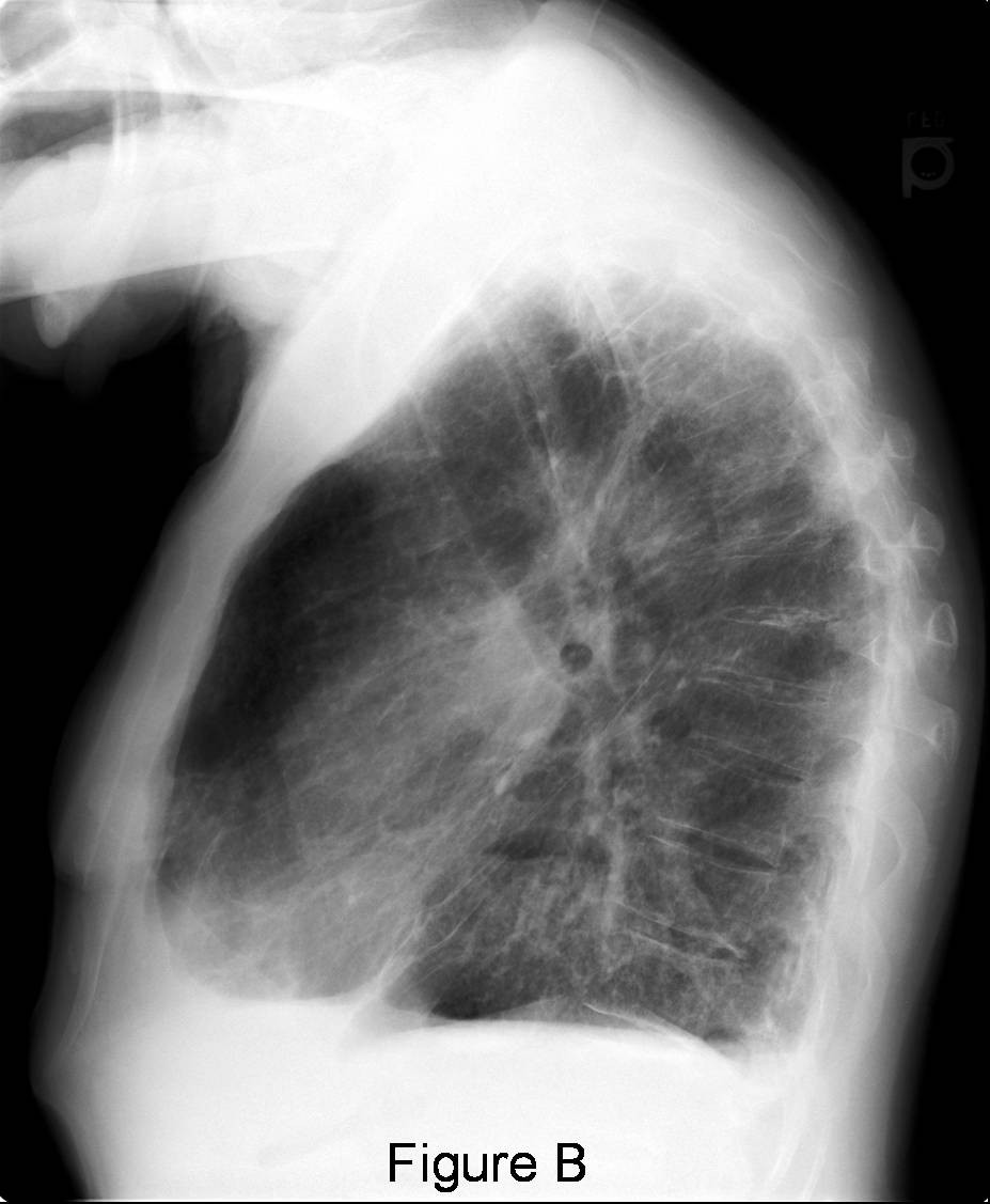 Radiograph 2 from archived case 26