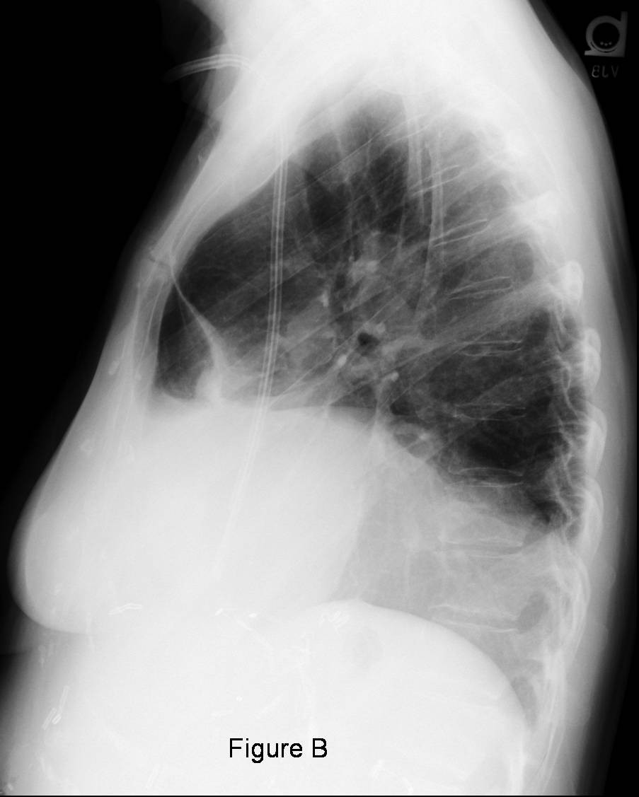 Radiograph 2 from archived case 44