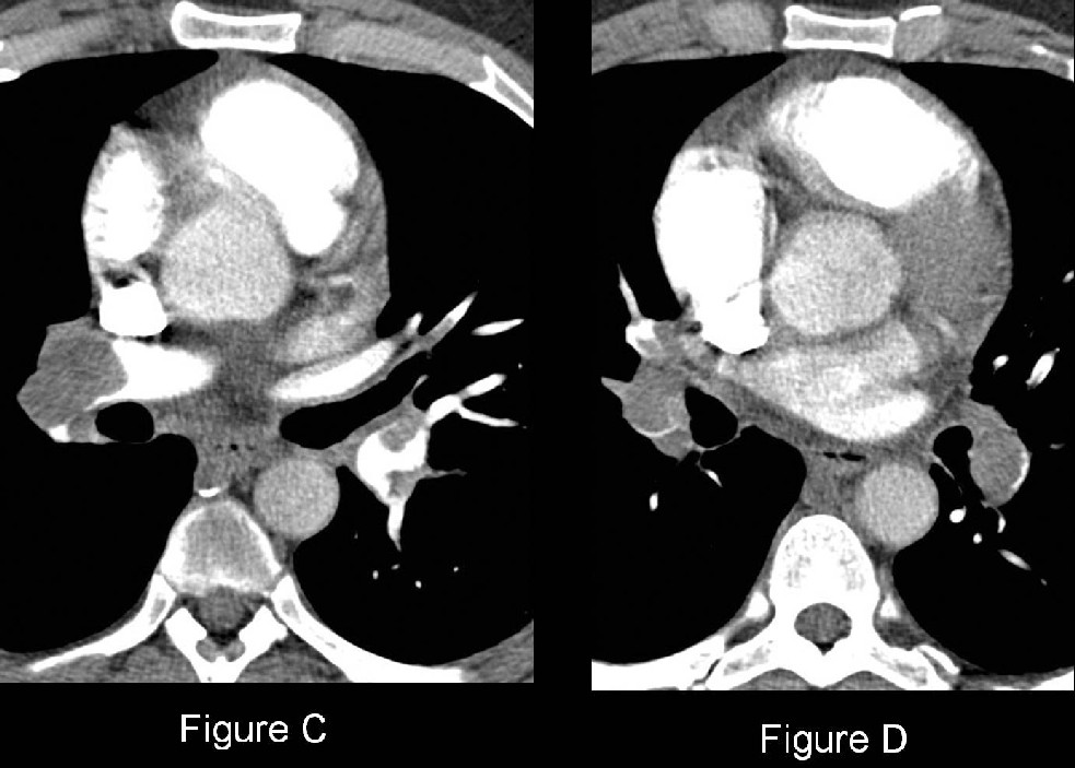 Radiograph 2 from archived case 41