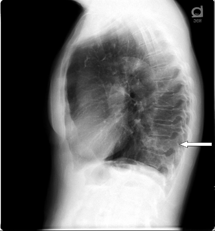 Radiograph 4 from archived case 11