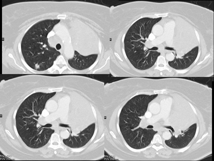 Radiograph 3 from archived case 2