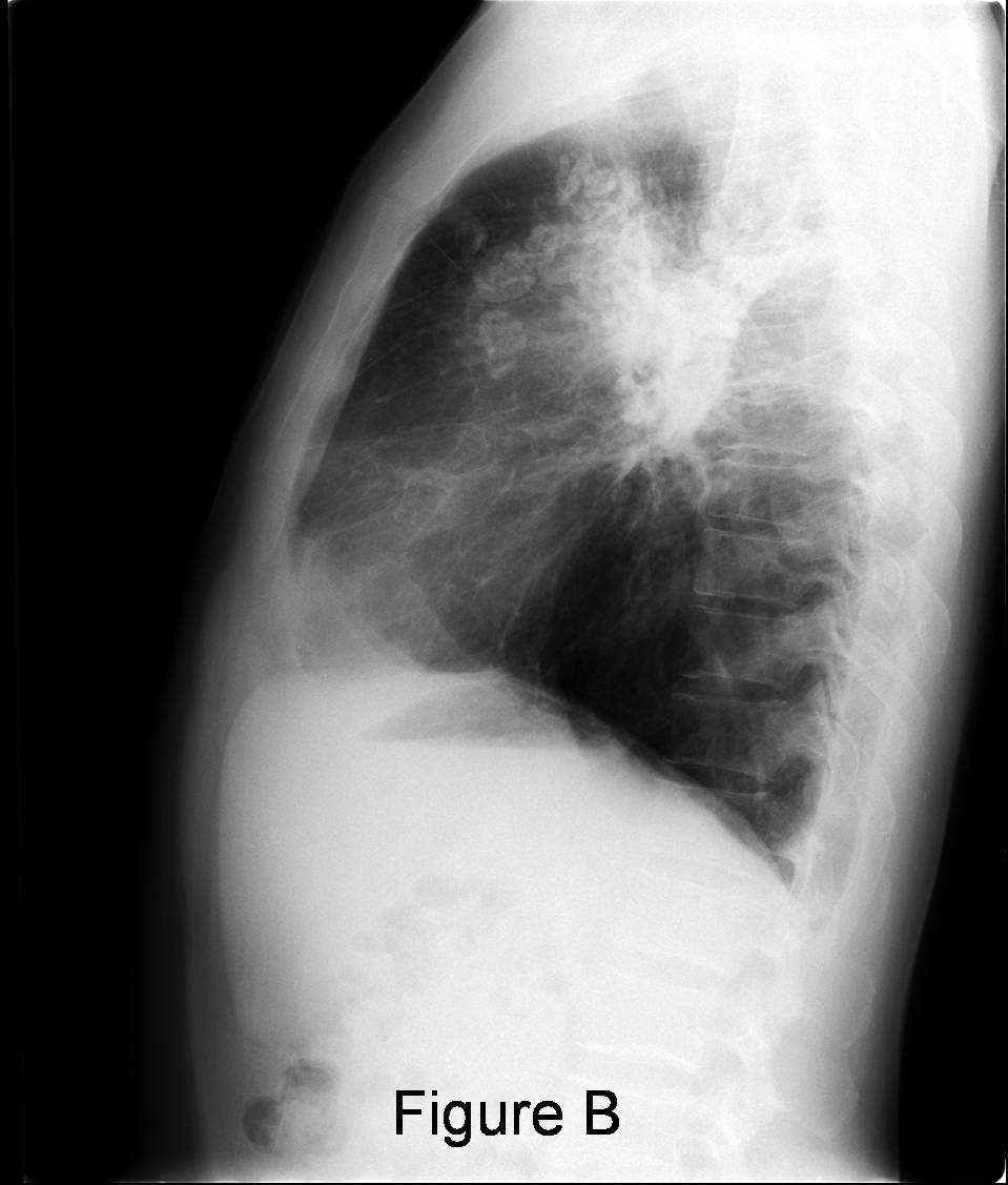 Radiograph 3 from archived case 21