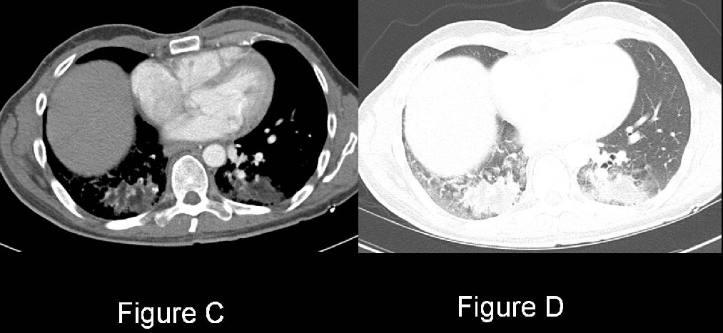Radiograph 4 from archived case 14
