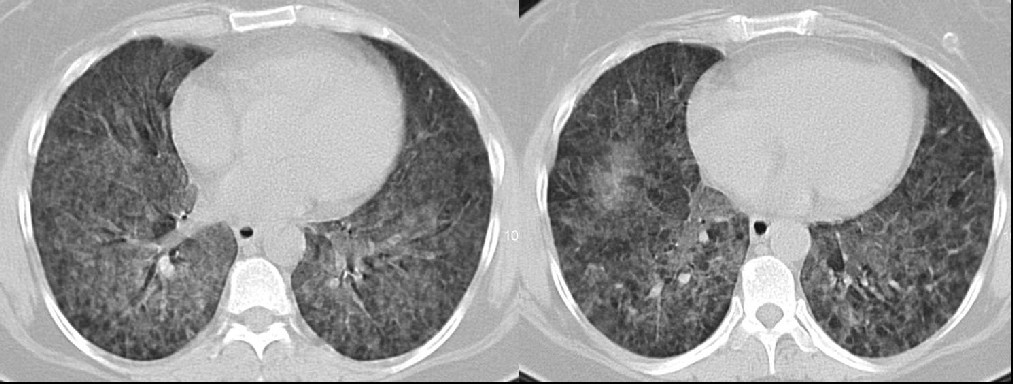 Radiograph 2 from archived case 22
