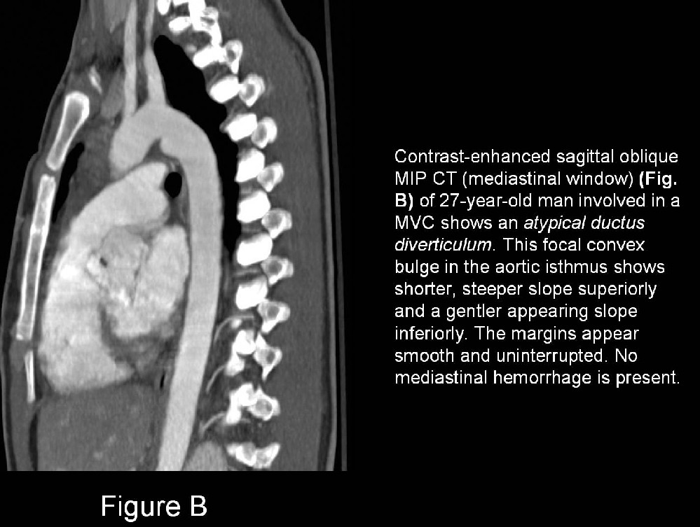 Radiograph 3 from archived case 17