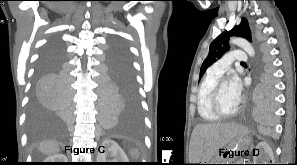 Radiograph 4 from archived case 32