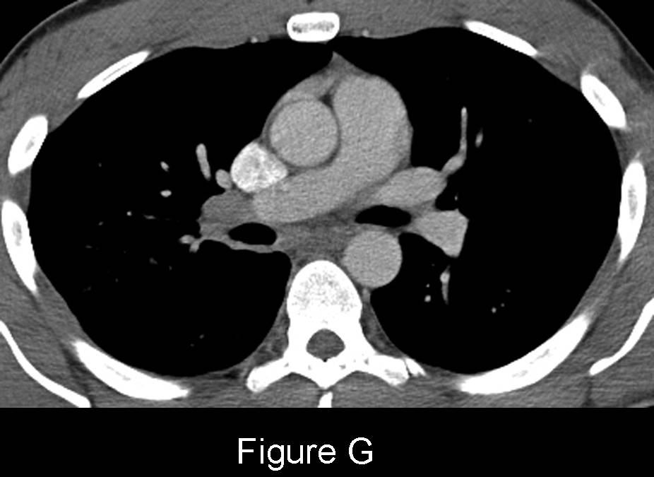 Radiograph 4 from archived case 48