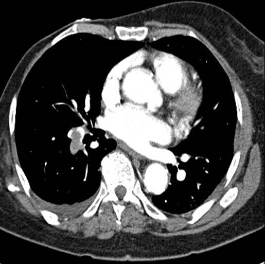 Radiograph 2 from archived case 3