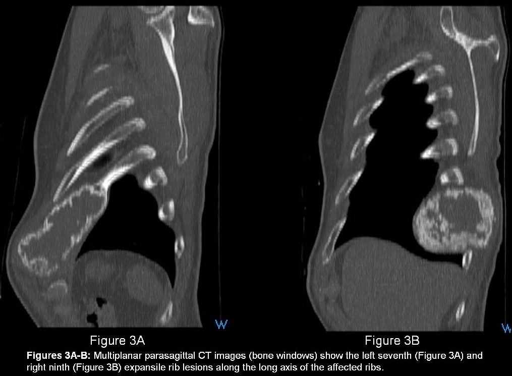 Radiograph 4 from archived case 9