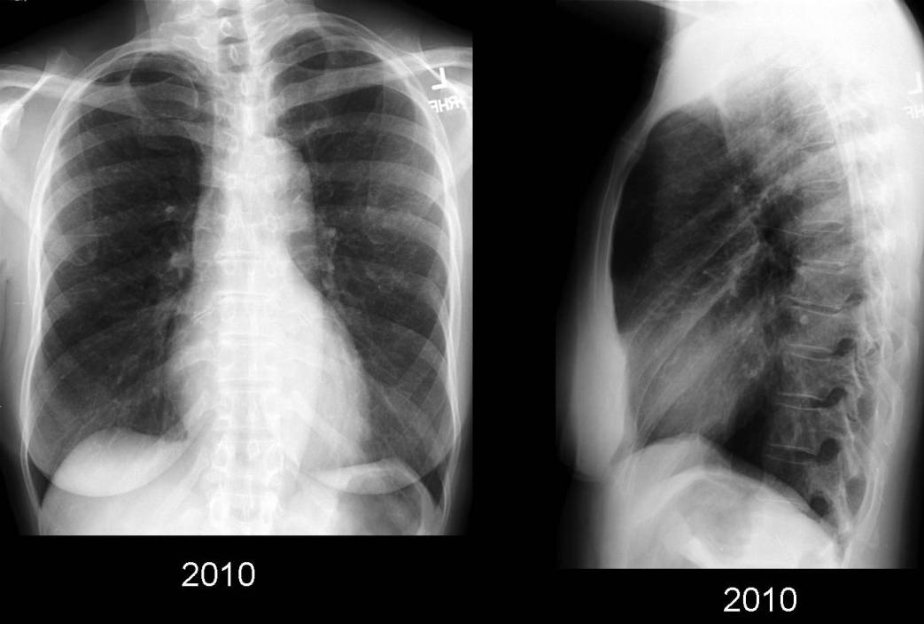 Radiograph 2 from archived case 49