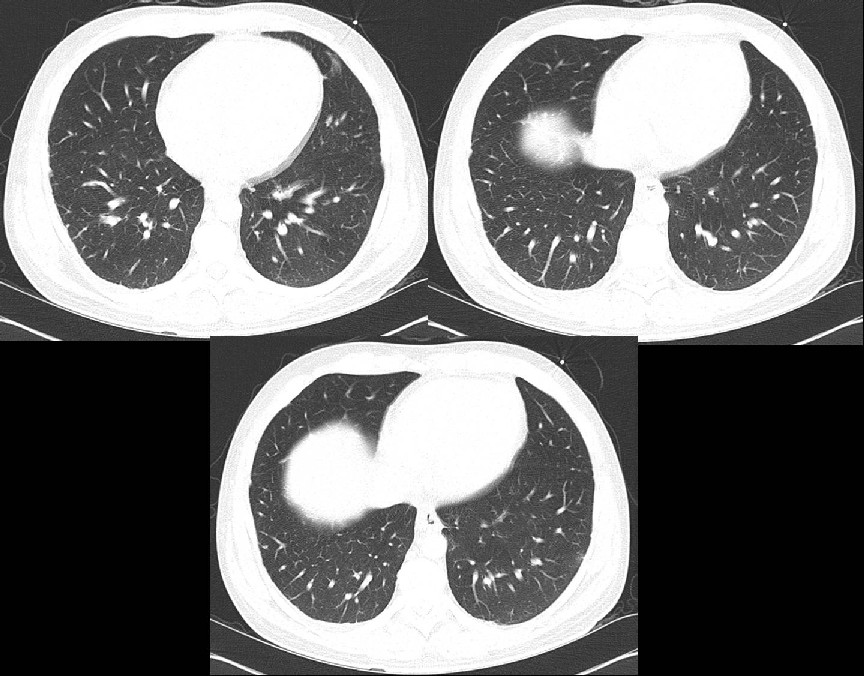 Radiograph 2 from archived case 4