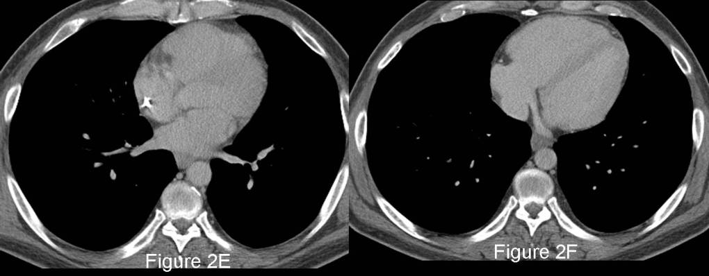 Radiograph 4 from archived case 83