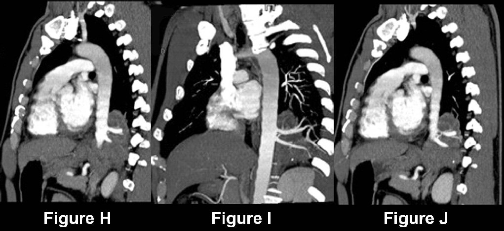 Radiograph 3 from archived case 18