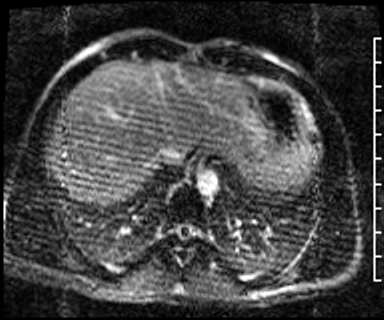 Radiograph 3 from archived case 73