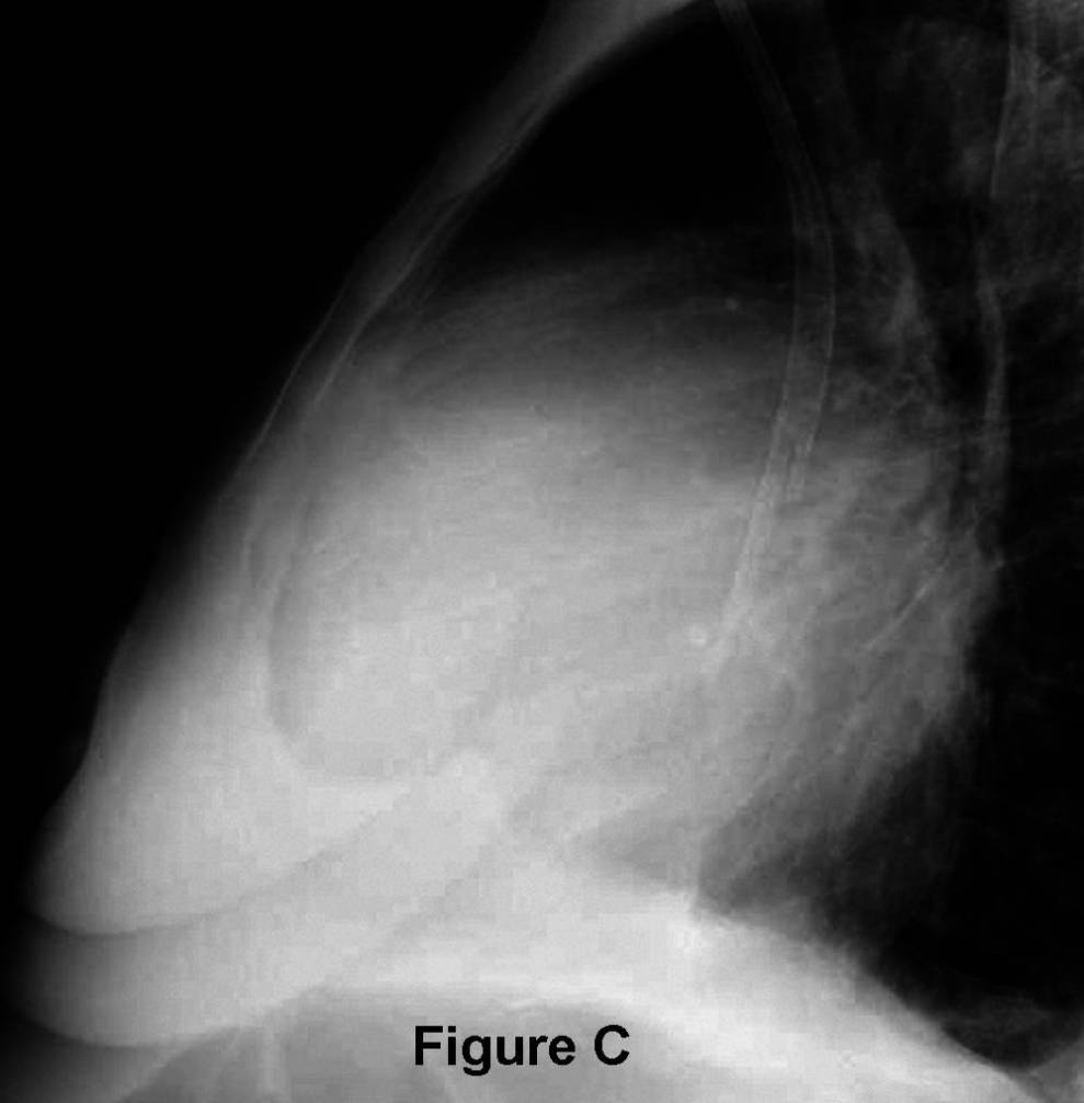 Radiograph 3 from archived case 52