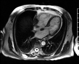 Radiograph 3 from archived case 61