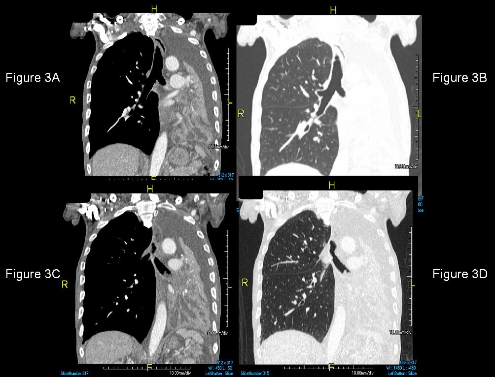 Radiograph 5 from archived case 35