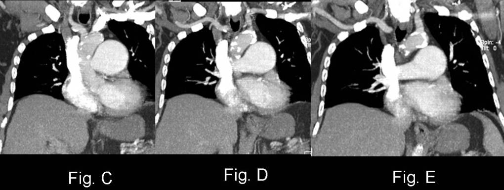 Radiograph 5 from archived case 46