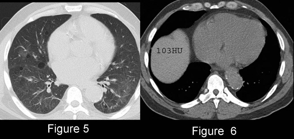 Radiograph 3 from archived case 56