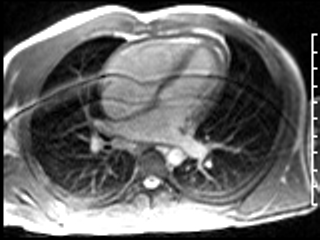 Radiograph 3 from archived case 38